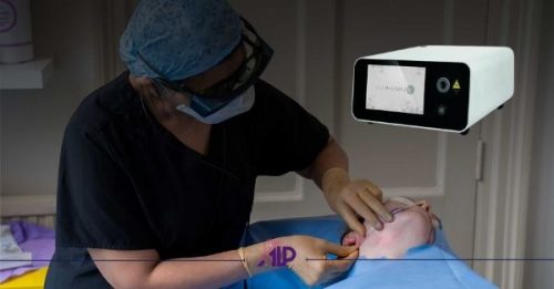 اندولیفت صورت