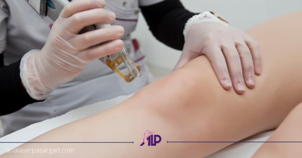 آریا لیزر اجاره لیزر