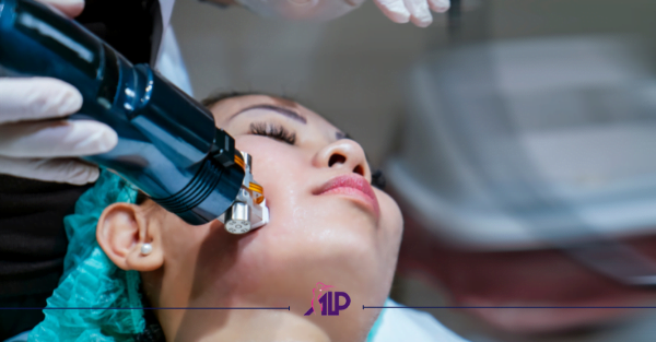 درمان جوش با میکرونیدلینگ