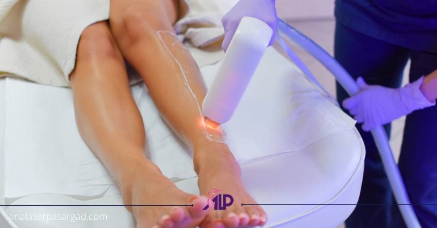 مراقبت بعد از لیزر موی زائد