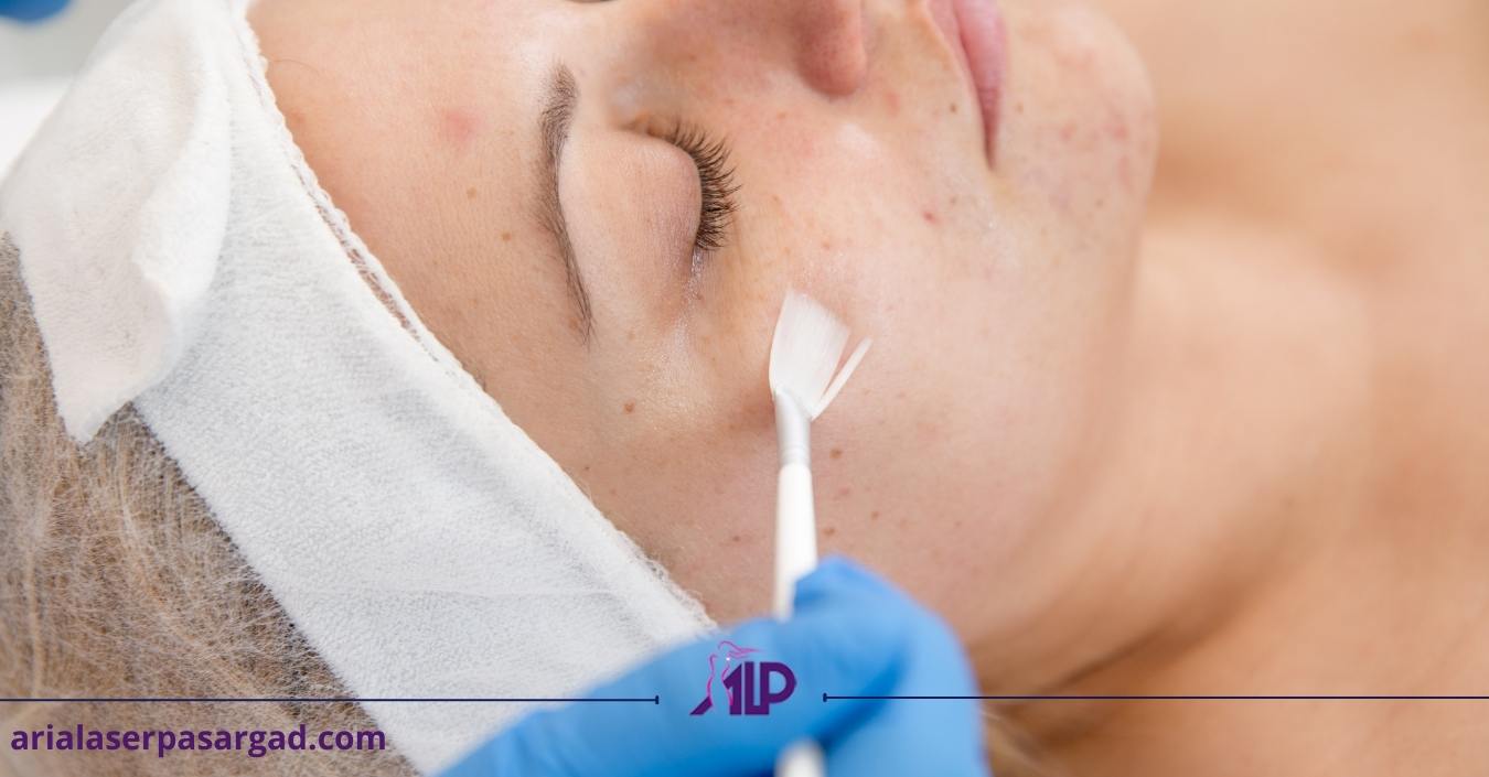 لایه برداری