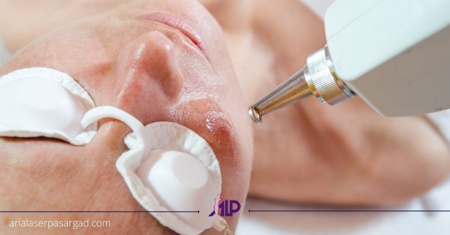 تاثیر لیزر درمانی