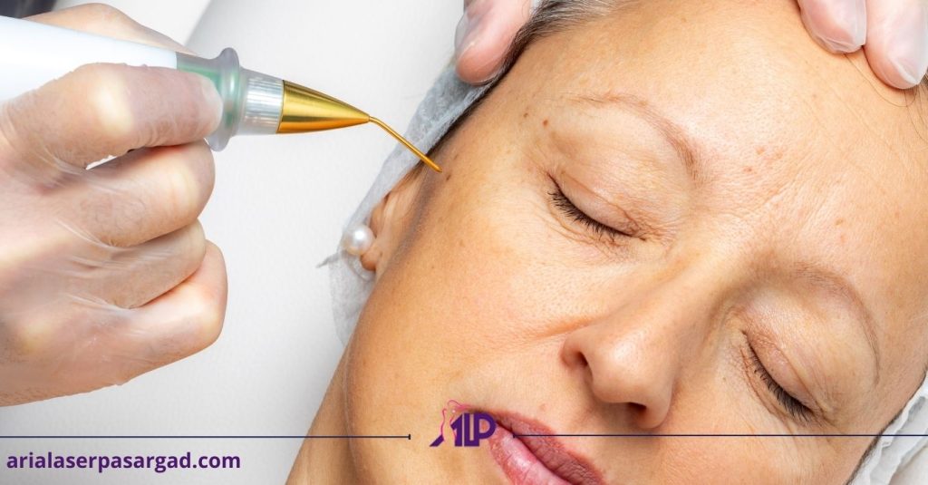 فیبروبلاست اصفهان