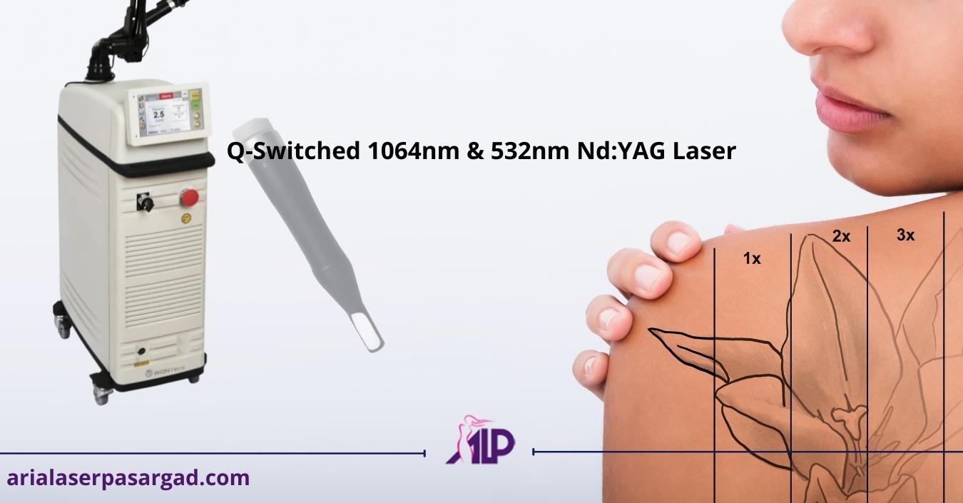 لیزر NDYAG کیوسوییچ