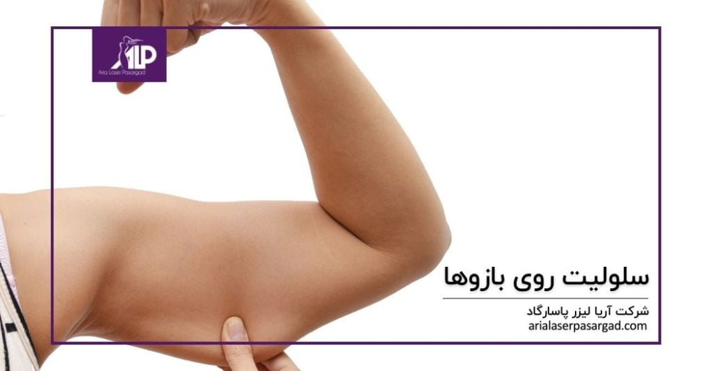 سلولیت روی بازوها