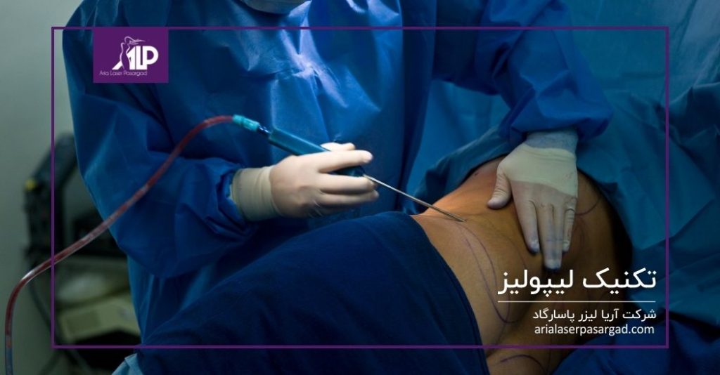 تکنیک لیپولیز