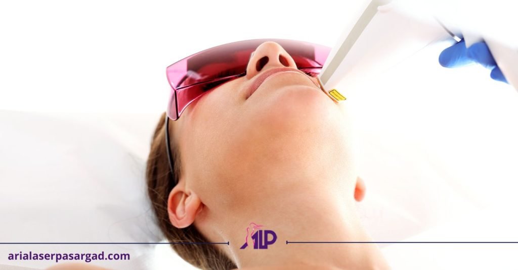 لیزر موی زائد صورت