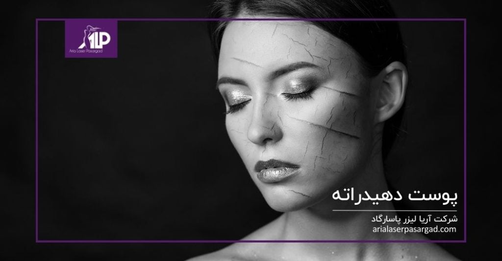 پوست کم آب و دهیدراته