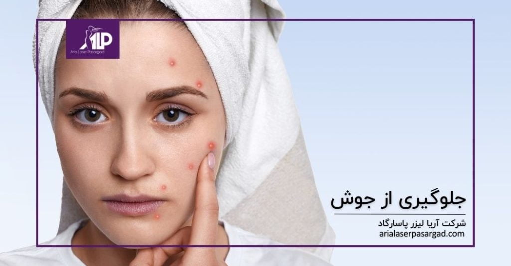 جلوگیری از جوش