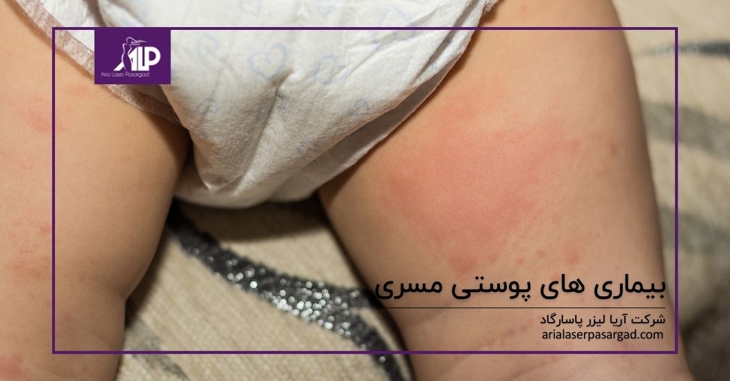 بیماری های پوستی مسری