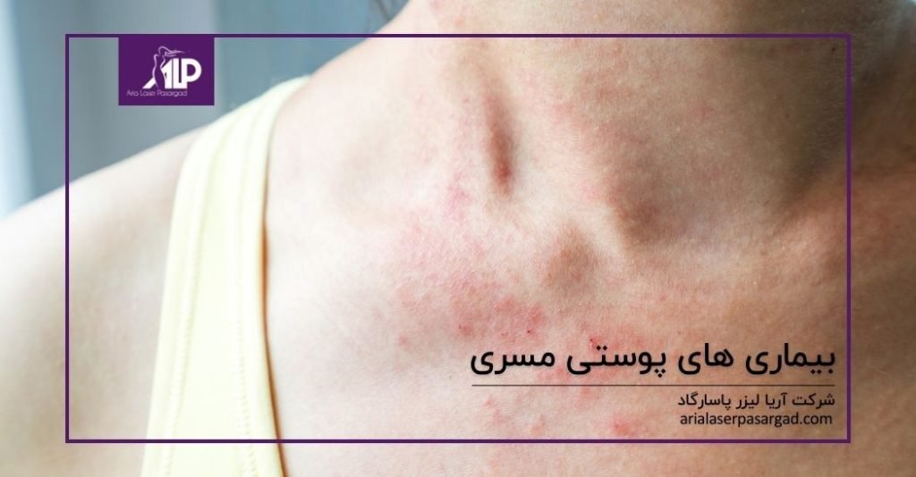 بیماری پوستی مسری