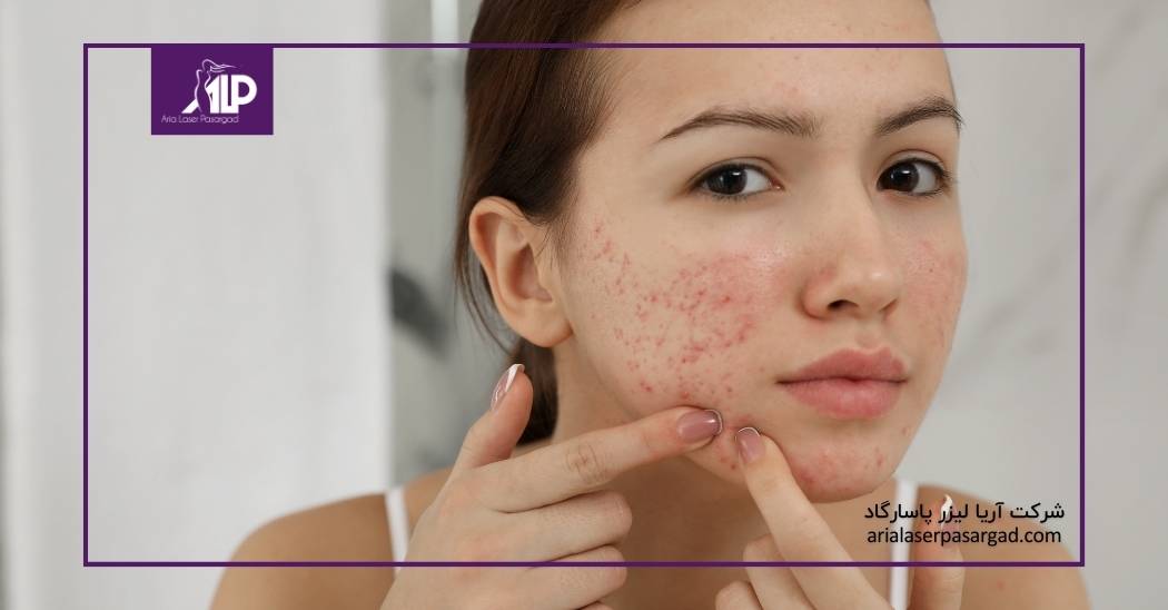 لکههای پوستی