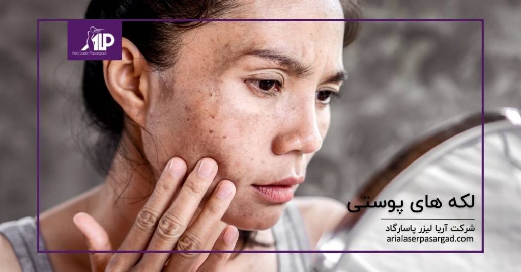 لکه‌های پوستی